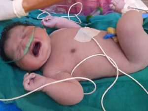 इंदौर में मध्यप्रदेश के सबसे वजनदार बच्चे का हुआ जन्म, वजन जान रह जाएंगे दंग- Khaber aaj ki