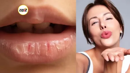 Winter Hacks: सर्दियों में होंठ क्यों फटते हैं? जानें कारण और इन तरीकों से पाएं मुलायम गुलाबी लिप्स फटे होंठों से राहत पाने के घर बैठे आसान उपाय