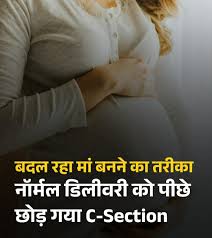 क्या बदल रहा है मातृत्व का तरीका? पहली बार C-सेक्शन ने नॉर्मल डिलीवरी को पीछे छोड़ा